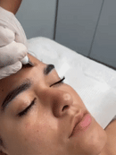 DermaClean Ultrasonic Pro — O Segredo das Esteticistas para Pele Sem Cravos e Poros Limpos em Casa