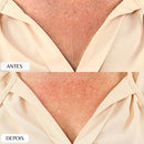 New Botox Skin Lift – Adesivo Anti Rugas Reutilizável para Linhas de Expressão