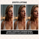 New Botox Skin Lift – Adesivo Anti Rugas Reutilizável para Linhas de Expressão