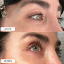 New Botox Skin Lift – Adesivo Anti Rugas Reutilizável para Linhas de Expressão