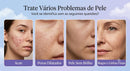 Mini HIFU Pro — Aparelho Facial 4 em 1 com HIFU, RF, EMS e LED para Cuidados com a Pele