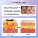 Mini HIFU Pro — Aparelho Facial 4 em 1 com HIFU, RF, EMS e LED para Cuidados com a Pele